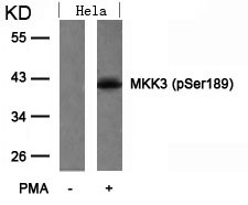 Anti-phospho-MKK3 (Ser189)