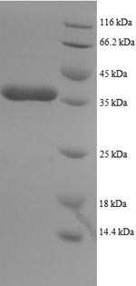 Dynein light chain 1, Cytoplasmic domain (DYNLL1), human, recombinant