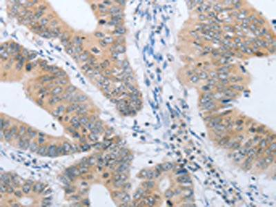Anti-CHRNA10