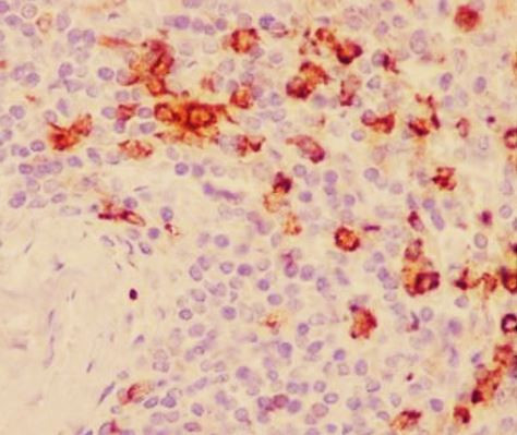 Anti-CD11b
