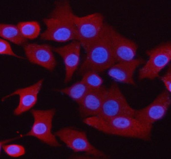 Anti-SYNGR1 / Synaptogyrin 1