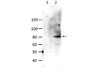 Anti-phospho-STAT6 (Tyr641)