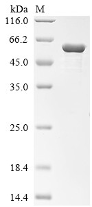 Desmin (DES), human, recombinant