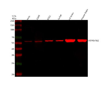 Anti-ATP6V1B2 / ATPase H+ transporting V1 subunit B2
