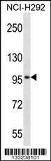 Anti-MID2, CT (MID2, FXY2, RNF60, TRIM1, Probable E3 ubiquitin-protein ligase MID2, Midin-2, Midline