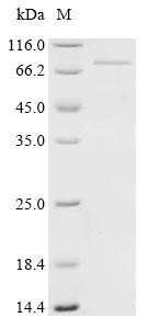 YTH domain-containing family protein 2 (YTHDF2), recombinant human