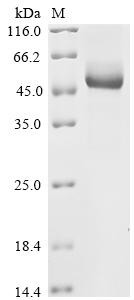 IGF-like family receptor 1 (Igflr1), partial, mouse, recombinant