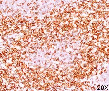 Anti-CD6, clone C6/372