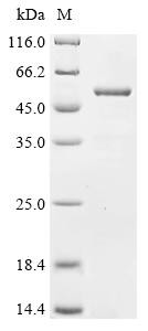 Katanin p60 ATPase-containing subunit A1 (KATNA1), partial, human, recombinant