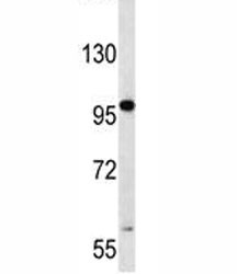 Anti-RNF43 / Ring finger protein 43