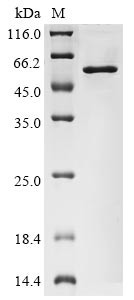 Nucleoprotein (N), human coronavirus HKU1, recombinant
