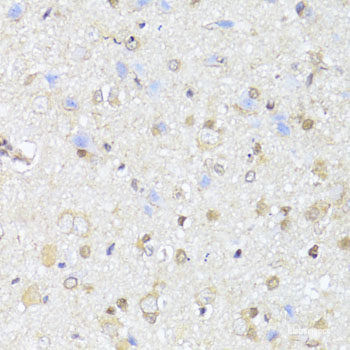 Anti-EGLN1/EGLN2