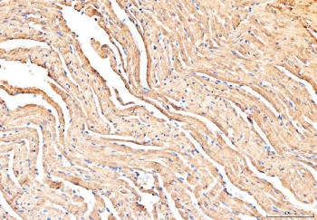 Anti-Phospholamban / PLN / PLB