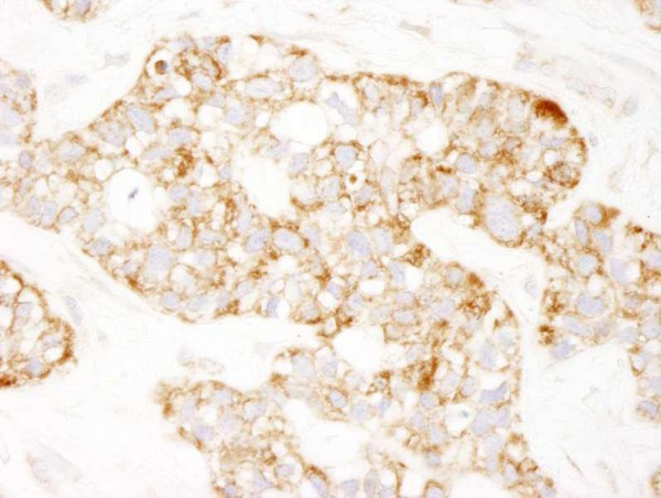 Anti-Prohibitin (IHC)