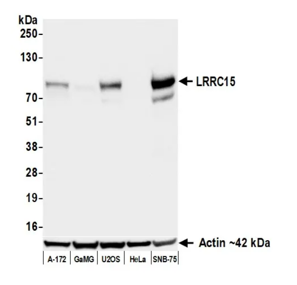 Anti-LRRC15 Recombinant Monoclonal