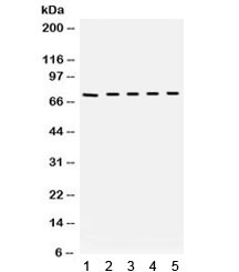 Anti-Bradykinin / Kininogen