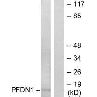 Anti-PFDN1