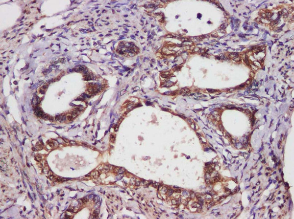 Anti-Bcl-2