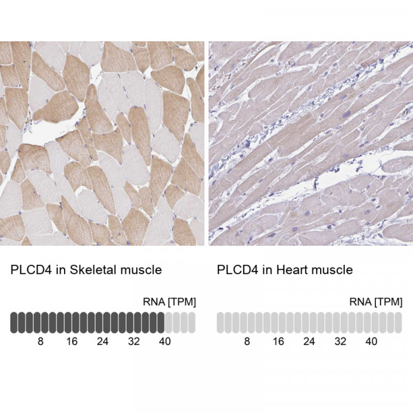 Anti-PLCD4