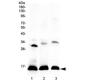 Anti-HBD / Hemoglobin subunit delta