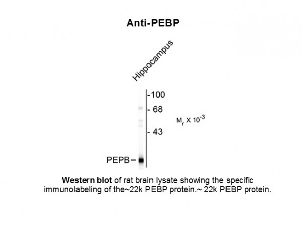 Anti-PEBP (phosphatidylethanolamie binding protein)