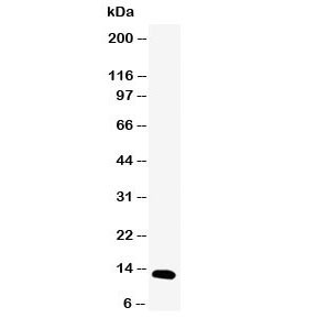 Anti-pS2 (Estrogen Inducible Protein )