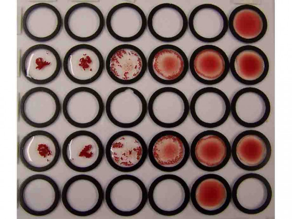 Anti-Red Blood Cells, human (RBC)