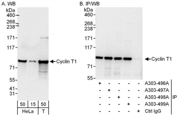 Anti-Cyclin T1