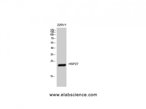 Anti-HSP27