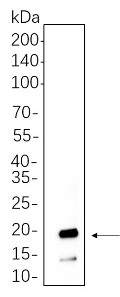 Anti-Recombinant Synuclein-alpha, clone 5A11