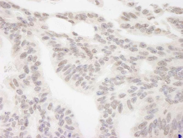 Anti-RBM12 (IHC)