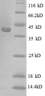 30S ribosomal protein S10 (rpsJ), Escherichia coli, recombinant