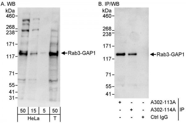 Anti-Rab3-GAP1