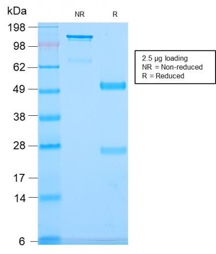 Anti-CD79b (B-Cell Marker), recombinant antibody, clone IGB/2940R