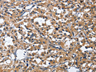 Anti-CDK5RAP3