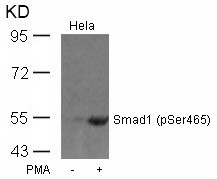 Anti-phospho-Smad1 (Ser465)