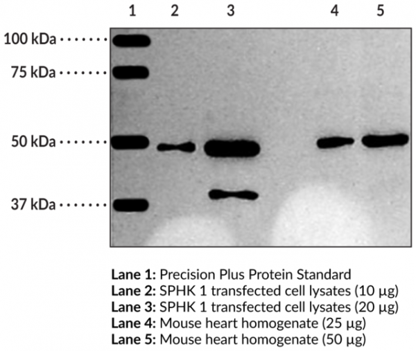 Anti-Sphingosine Kinase 1