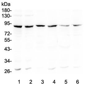 Anti-Bcl6
