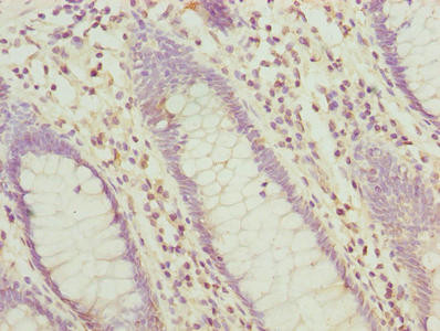 Anti-HABP2