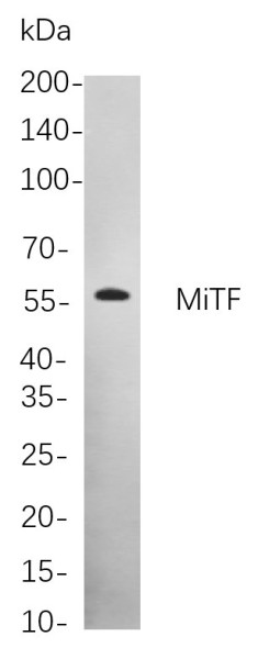 Anti-Recombinant MiTF, clone 2C7
