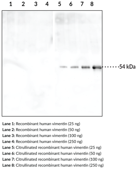 Anti-Citrullinated Vimentin (Clone 12G11)