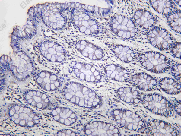Anti-Recombinant SIRT2, clone C112437