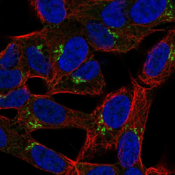 Anti-LRRTM1