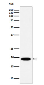 Anti-MSRB3 / Methionine sulfoxide reductase B3, clone 29M98
