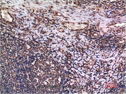 Anti-Cyclin B1, clone 1A5