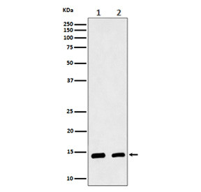 Anti-CRABP2 / Cellular retinoic acid-binding protein 2, clone 30C81