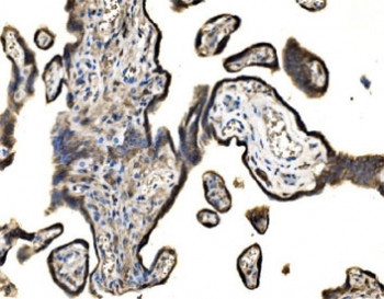Anti-SND1 / Staphylococcal nuclease domain-containing protein 1 antibody / TDRD11