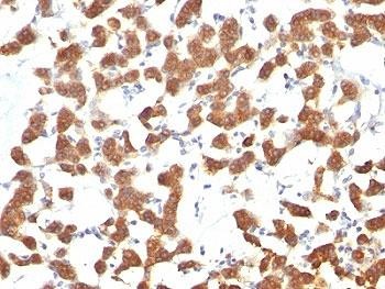 Anti-Cytokeratin 18, clone C-04 or Ks18.04