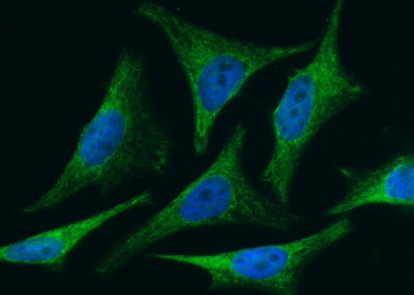 Anti-BID Monoclonal Recombinant Antibody