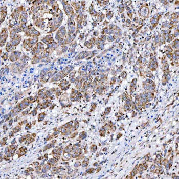 Anti-SUCLG2 / Succinate-CoA ligase GDP-forming subunit beta